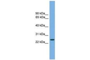 Image no. 1 for anti-Charged Multivesicular Body Protein 4B (CHMP4B) (AA 71-120) antibody (ABIN6745025) (CHMP4B antibody  (AA 71-120))
