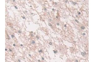 Immunohistochemistry (IHC) image for anti-Nuclear Receptor Coactivator 3 (NCOA3) (AA 1023-1304) antibody (ABIN7441217)