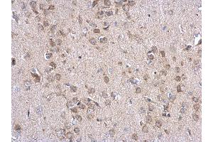 IHC-P Image INPP5F antibody detects INPP5F protein at cytosol on mouse fore brain by immunohistochemical analysis.