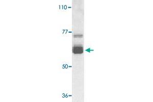 Western blot analysis of IL22RA1 expression in human HepG2 cell lysate with IL22RA1 polyclonal antibody  at 1 ug /mL . (IL22 Receptor alpha 1 antibody  (N-Term))
