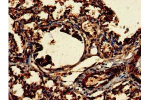 Immunohistochemistry of paraffin-embedded human lung tissue using ABIN7147821 at dilution of 1:100 (Clarin 2 antibody  (AA 31-100))