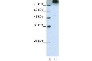 WB Suggested Anti-EIF3S9  Antibody Titration: 0.