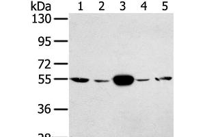 Western Blot analysis of Hela and K562 cell, Human fetal muscle tissue, A375 and hepg2 cell using TRIM35 Polyclonal Antibody at dilution of 1:400 (TRIM35 antibody)