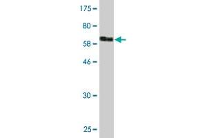 Western Blot detection against Immunogen (67. (CKM antibody  (AA 1-381))