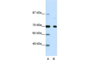 Western Blotting (WB) image for anti-Nuclear Receptor Co-Repressor 2 (NCOR2) antibody (ABIN2460476) (NCOR2 antibody)