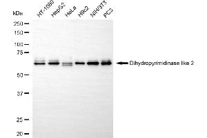 Western blotting analysis using dihydropyrimidinase like 2 antibody (ABIN7798337). (Recombinant DPYSL2 antibody)