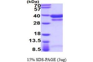 SDS-PAGE (SDS) image for Cathepsin B (CTSB) (AA 18-339) protein (His tag) (ABIN5854523) (Cathepsin B Protein (CTSB) (AA 18-339) (His tag))
