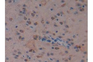 DAB staining on IHC-P; Samples: Mouse Cerebrum Tissue (MST1 antibody  (AA 469-704))