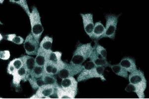 Immunofluorescent staining of ES2 cells with anti-IKKgamma antibody. (IKBKG antibody  (AA 278-396))