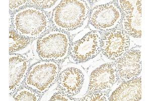 ABIN6259171 and ABIN6275708 at 1/100 staining Rat testis tissue by IHC-P.