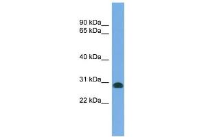 WB Suggested Anti-CENPH Antibody Titration: 0. (CENPH antibody  (N-Term))