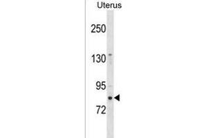 ZN Antibody (N-term) (ABIN1539004 and ABIN2850297) western blot analysis in Uterus tissue lysates (35 μg/lane). (ZNF853 antibody  (N-Term))