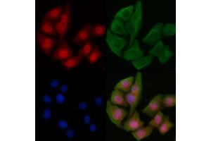 ABIN6255040 and ABIN6267230 staining Hela cells by IF/ICC. (IKK-alpha /IKK-beta antibody  (pSer180, pSer181))