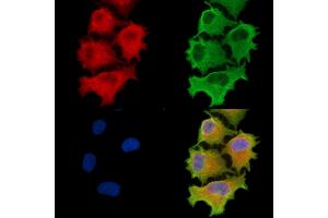 ABIN6260768 and ABIN6279276 staining  cells by IF/ICC.