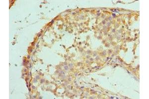 Immunohistochemistry of paraffin-embedded human testis tissue using ABIN7150715 at dilution of 1:100 (MAP2K5 antibody  (AA 1-190))