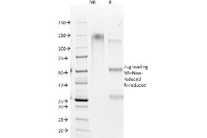 SDS-PAGE Analysis Purified HSA Mouse Monoclonal Antibody (HSA98). (Hepatocyte Specific Antigen antibody)