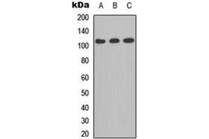Western blot analysis of CD41 LC 1 expression in A549 (A), MCF7 (B), PC12 (C) whole cell lysates. (CD41 LC 1 (C-Term) antibody)