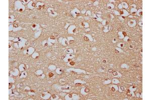 IHC image of ABIN7166521 diluted at 1:300 and staining in paraffin-embedded human brain tissue performed on a Leica BondTM system. (PCDHa8 antibody  (AA 719-922))