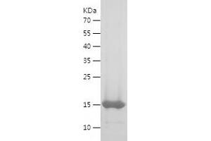 Western Blotting (WB) image for Calprotectin (S100A8/A9) (AA 1-119) protein (His tag) (ABIN7283258) (Calprotectin Protein (S100A8/A9) (AA 1-119) (His tag))