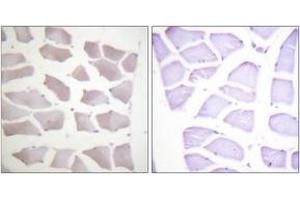 Immunohistochemistry analysis of paraffin-embedded human skeletal muscle tissue, using CRYAB (Ab-19) Antibody. (CRYAB antibody  (AA 10-59))