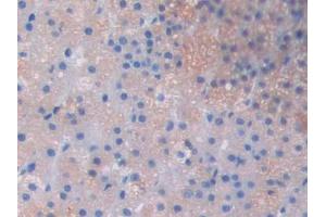 Used in DAB staining on fromalin fixed paraffin- embedded skeletal muscle tissue (LOXL2 antibody  (AA 434-546))