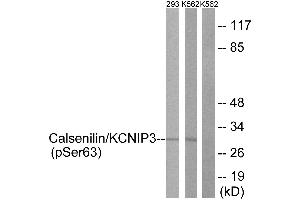 Immunohistochemistry analysis of paraffin-embedded human brain tissue using Calsenilin/KCNIP3 (Phospho-Ser63) antibody. (DREAM antibody  (pSer63))