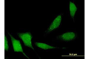 Immunofluorescence of monoclonal antibody to APPL2 on HeLa cell. (APPL2 antibody  (AA 174-273))