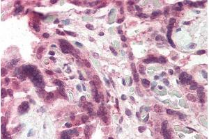 Immunohistochemistry (IHC) image for anti-Cholecystokinin B Receptor (CCKBR) (Internal Region) antibody (ABIN185407)