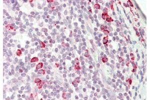 Rabbit Anti-KIAA0317 antibody  Formalin Fixed Paraffin Embedded Tissue: Human Tonsil Primary antibody Concentration: 1:100 Secondary Antibody: Donkey anti-Rabbit-Cy3 Secondary Antibody Concentration: 1:200 Magnification: 20x Exposure Time: 0. (AREL1 antibody  (N-Term))