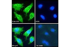 ABIN6391344 Immunofluorescence analysis of paraformaldehyde fixed HepG2 cells, permeabilized with 0. (CTGF antibody  (Internal Region))