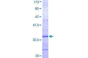 SYVN1 Protein (AA 238-318) (GST tag)