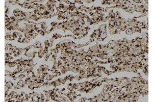 ABIN6272402 at 1/100 staining Human lung tissue by IHC-P. (PSKH1 antibody  (Internal Region))