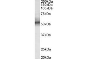 AP31785PU-N TRIM11 antibody staining of Human spleen lysate at 0. (TRIM11 antibody  (Internal Region))