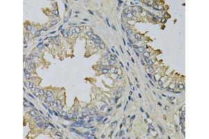 Immunohistochemistry of paraffin-embedded Human prostate using LITAF Polyclonal Antibody at dilution of 1:100 (40x lens). (LITAF antibody)