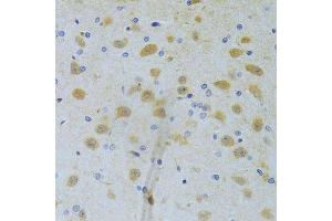 Immunohistochemistry of paraffin-embedded rat brain using CHIA Antibody. (CHIA antibody  (AA 1-368))