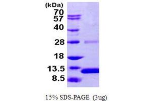 SDS-PAGE (SDS) image for S100 Calcium Binding Protein A2 (S100A2) (AA 1-97) protein (His tag) (ABIN667377)
