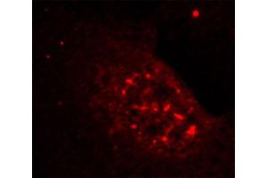 Immunofluorescence (IF) image for anti-V-Akt Murine Thymoma Viral Oncogene Homolog 1 (AKT1) (pThr308) antibody (ABIN1869972)