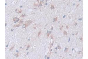 Detection of CAPNS1 in Human Cerebrum Tissue using Polyclonal Antibody to Calpain, Small Subunit 1 (CAPNS1) (Calpain S1 antibody  (AA 1-268))