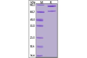 Mouse Complement C5, His Tag on  under reducing (R) condition. (C5 Protein (AA 19-1680) (His tag))