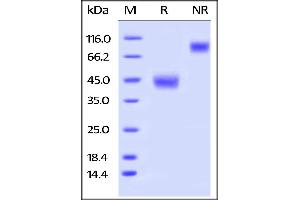 Human LAP (TGF-beta 1), His Tag on SDS-PAGE under reducing (R) and no-reducing (NR) conditions. (Leucine Peptidase (AA 30-278) protein (His tag))