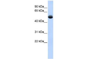 WB Suggested Anti-TRAM1L1 Antibody Titration: 0. (TRAM1L1 antibody  (Middle Region))
