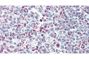 Immunohistochemistry of paraffin-embedded Tonsil tissue using LTB Polyclonal Antibody at dilution of 1:90. (LTB antibody)