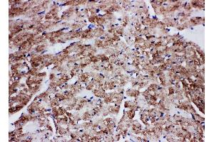 Anti-Glucose Transporter GLUT4 antibody, IHC(P) IHC(P): Rat Cardiac Muscle Tissue