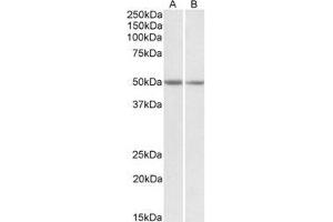 AP20123PU-N GNAS antibody staining of Mouse brain (Lane A) and Rat brain (Lane B) at 0.
