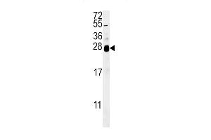 ZN Antibody (C-term) (ABIN651881 and ABIN2840437) western blot analysis in  cell line lysates (35 μg/lane). (RNF114 antibody  (C-Term))