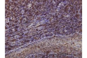 Immunoperoxidase of monoclonal antibody to EMD on formalin-fixed paraffin-embedded human tonsil. (Emerin antibody  (AA 1-110))