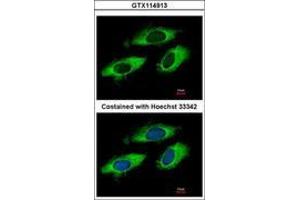 Image no. 3 for anti-Ribosomal Protein L6 (RPL6) (AA 7-223) antibody (ABIN1500745) (RPL6 antibody  (AA 7-223))