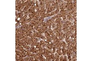 Immunohistochemical staining of human liver with C16orf46 polyclonal antibody  shows strong cytoplasmic positivity in hepatocytes. (C16ORF46 antibody)