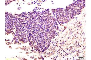ZDHHC9 antibody  (AA 118-155)