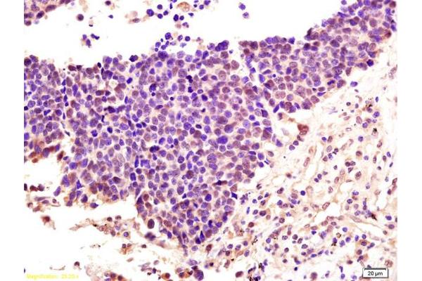 ZDHHC9 antibody  (AA 118-155)